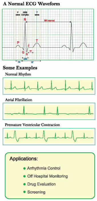 InstantCheck handheld ECG