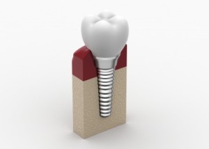 favorite plus dental